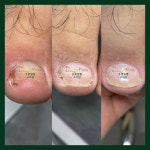 디에고푸스 구의점 초롱쌀롱