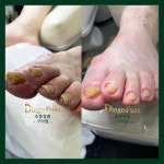 디에고푸스 구의점 초롱쌀롱