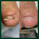 디에고푸스 구의점 초롱쌀롱