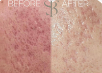 스무살에머물다 논산취암점