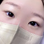 블링유