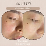 더플러스채우다