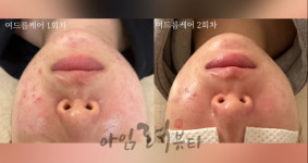 아임려뷰티 에스테틱