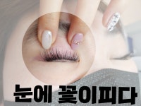 눈에꽃이피다