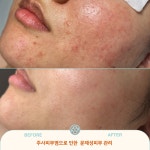 데비스킨 인천점