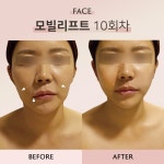 메디스파 연