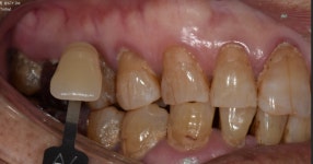 하나치과기공소