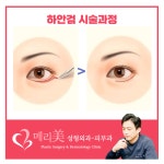 메리미의원