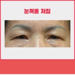 메리미의원