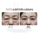 잇츠미의원 천안불당