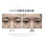 잇츠미의원 천안불당