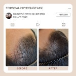 탑스칼프 평택점