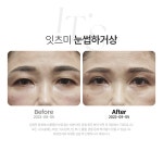 잇츠미의원 천안불당