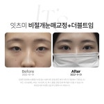 잇츠미의원 천안불당