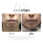 잇츠미의원 천안불당