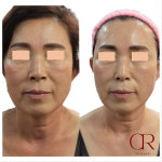 클라온 에스테틱 양주옥정점