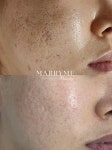 플라즈마블라스트&메리미뷰티