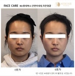 미본 얼굴윤곽관리 일산점
