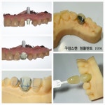 바라던치과기공소