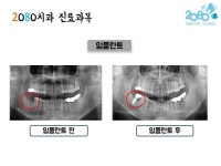 2080치과의원