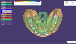 트렌디치과기공소