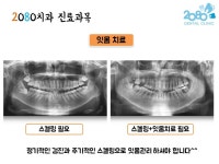 2080치과의원