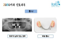 2080치과의원