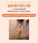 하늘호수피부과의원