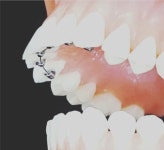 연세윌치과의원