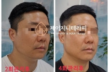 제이지니테라피