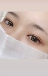 미플렉스