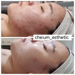 채움에스테틱 진주평거점