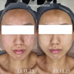 채움에스테틱 진주평거점