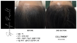 라온하제 두피 탈모케어 눈썹 속눈썹펌 천안본점