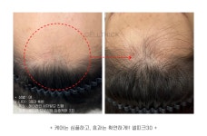 라온하제 두피 탈모케어 눈썹 속눈썹펌 천안본점