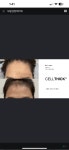 라온하제 두피 탈모케어 눈썹 속눈썹펌 천안본점