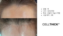 라온하제 두피 탈모케어 눈썹 속눈썹펌 천안본점