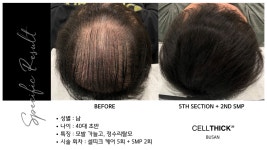라온하제 두피 탈모케어 눈썹 속눈썹펌 천안본점