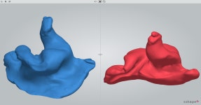 올바른보청기 수원역점