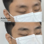 아르떼스칼프