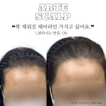아르떼스칼프