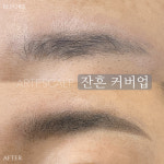 아르떼스칼프