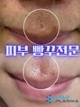플라즈마헤베 울산본점