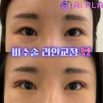 플라즈마헤베 울산본점