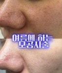 플라즈마헤베 울산본점