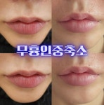 플라즈마헤베 울산본점