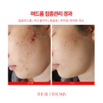 더좋은피부