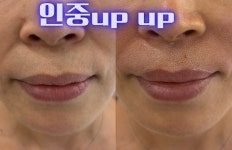 플라즈마헤베 울산본점