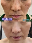 플라즈마헤베 울산본점