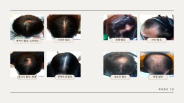 웰킨두피탈모센터 시흥배곧점